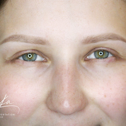 healed result after 1 session of pmu; powder tehnique