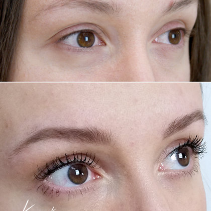 healed result after 1 session of pmu; powder tehnique